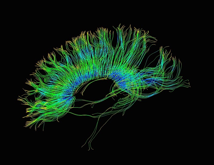 According to a study that was overseen by Ph.D. Staci Gruber of McLean Hospital, marijuana heightens the performance of cognitive tasks mediated by the frontal cortex. Callista Images/ Getty Images