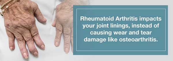 Rheumatoid Arthritis Vs. Osteoarthritis