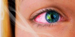 How to Get Rid of Red Eyes After Smoking Weed