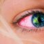 How to Get Rid of Red Eyes After Smoking Weed